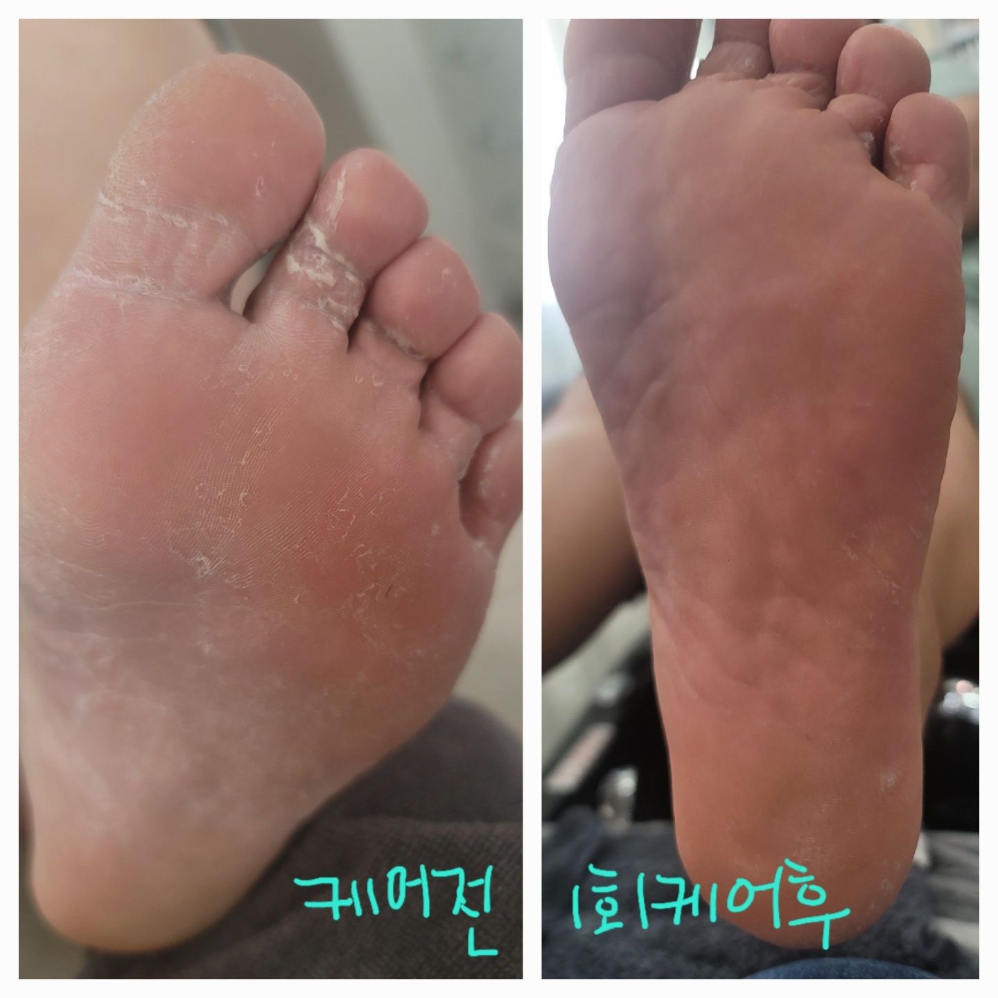 2000769928_oOCmWRPs_bf62b5c237146d97acb677558d25b34a312b28ff.jpg 이미지크게보기